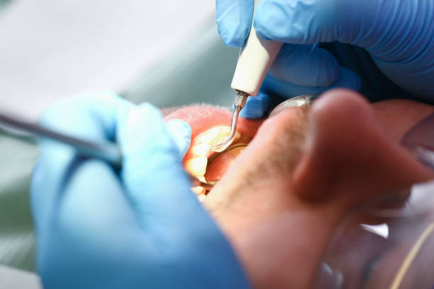 Trusted MI Emergency Dentist Experts