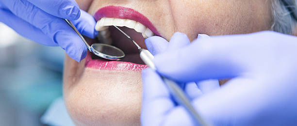 Best Emergency Broken Tooth Repair in Byron Center, MI